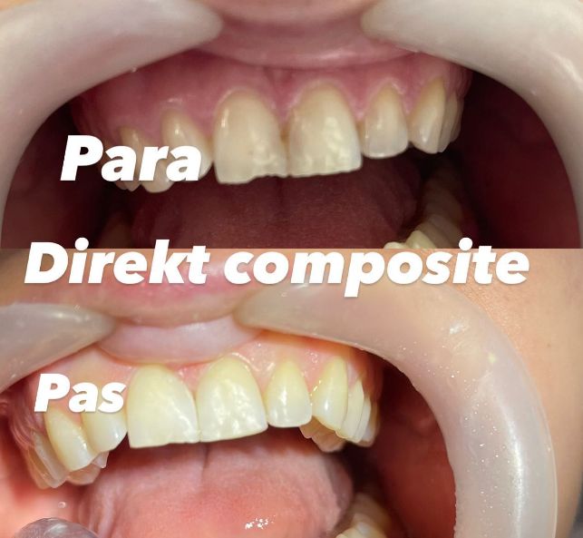_______dentist-klinike-bryli-tirane-195