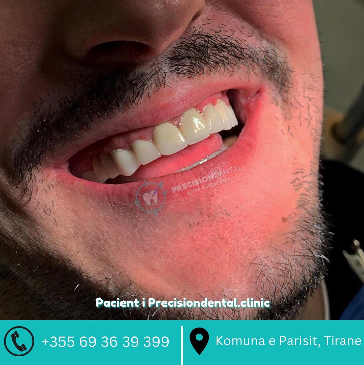 _________dentist-tirane-195