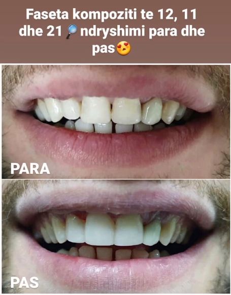 aiden-dental-dentist-tirane-192