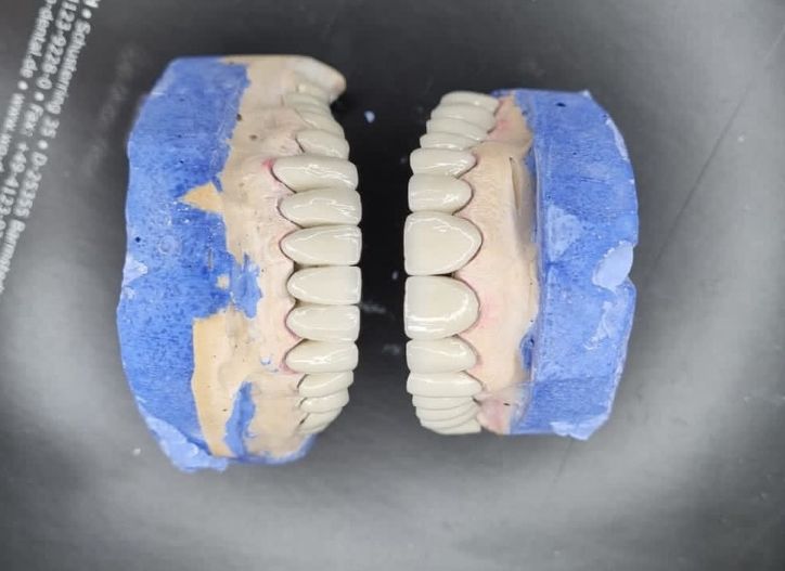aiden-dental-dentist-tirane-199