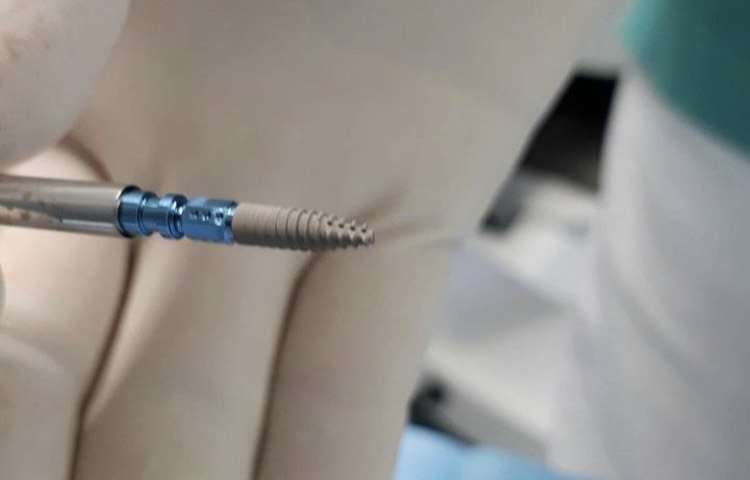 implante-dentist-dentare-kodra-diellit-196