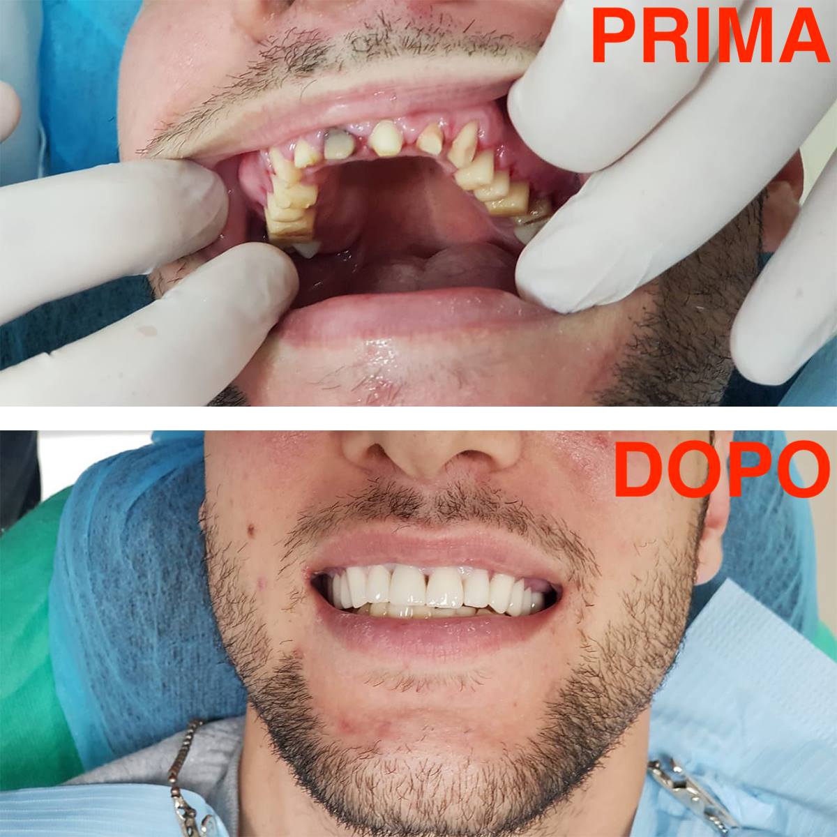 _________Dentist-ne-durres-153