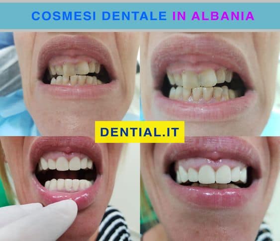 _________Dentist-ne-durres-16