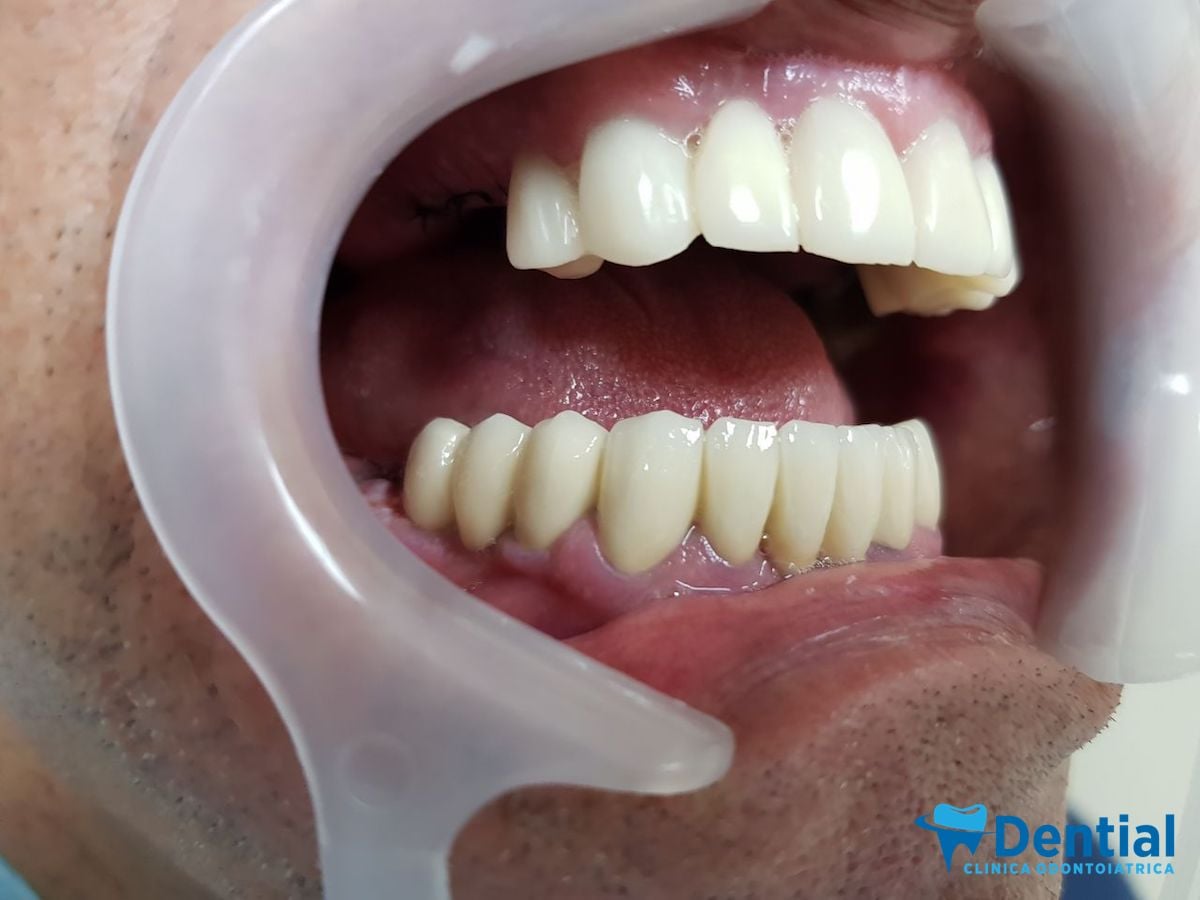 _________Dentist-ne-durres-19