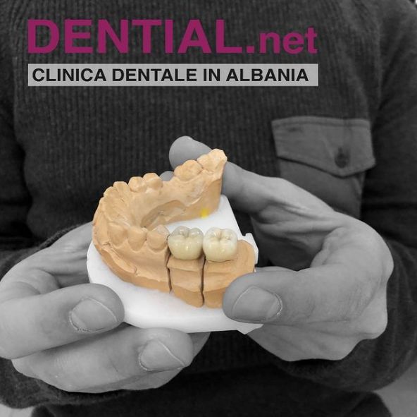 _________Dentist-ne-durres-194