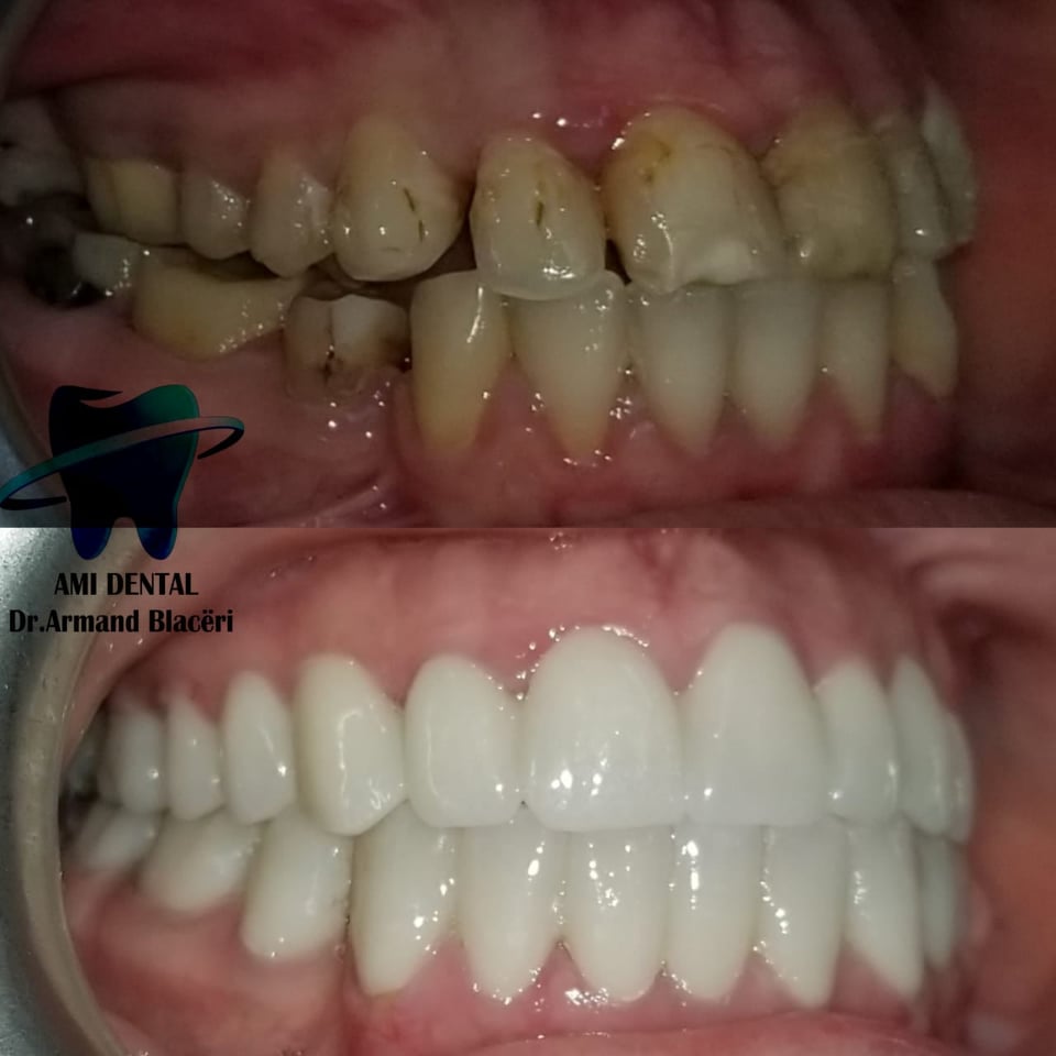 ______Klinike-dentare-vlore-11