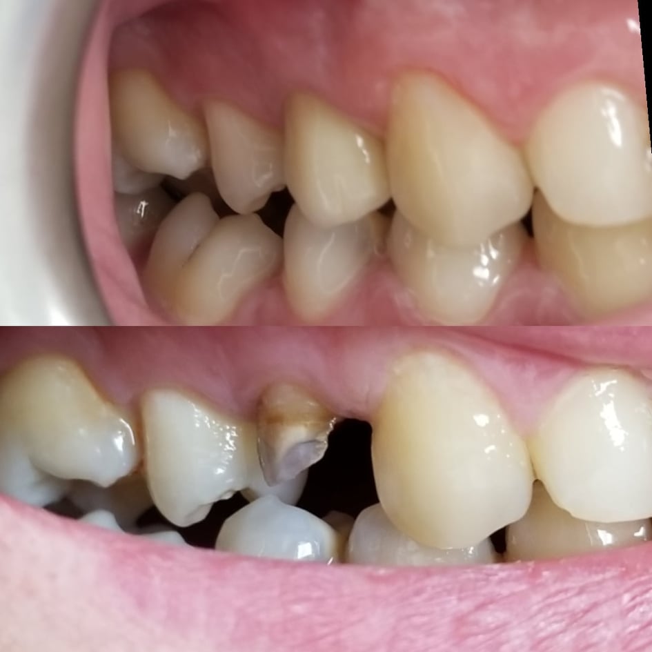 ______Klinike-dentare-vlore-14