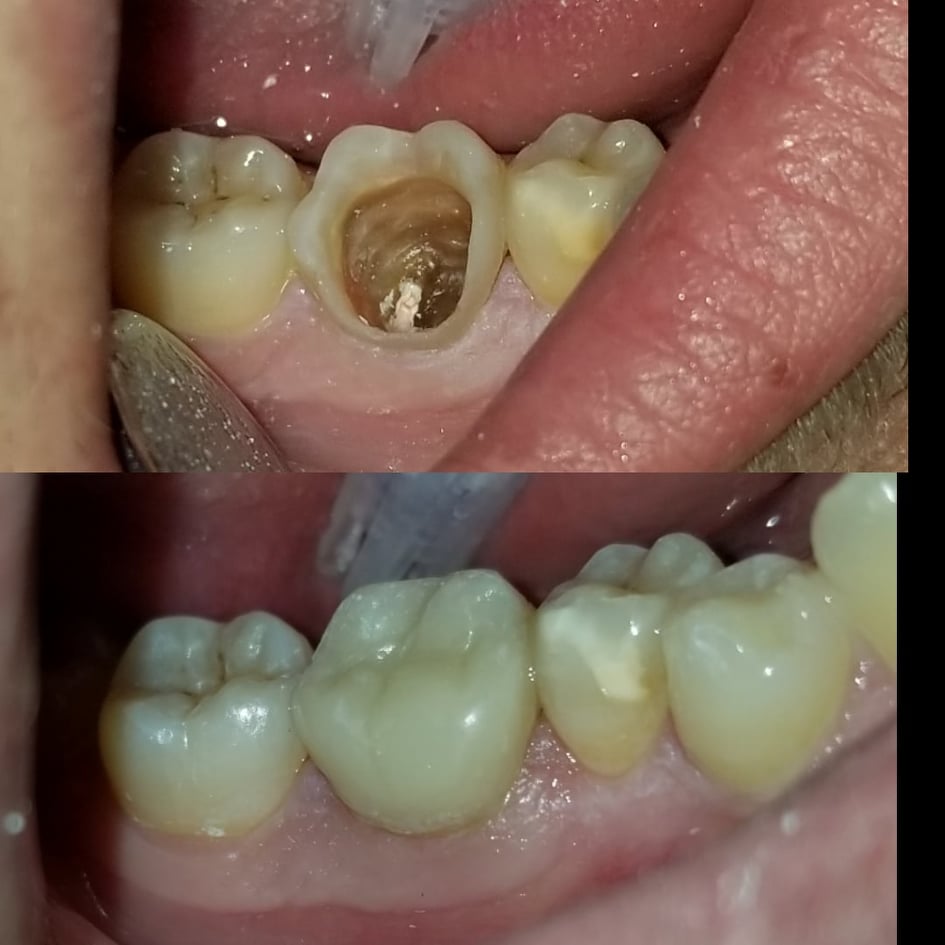 ______Klinike-dentare-vlore-15