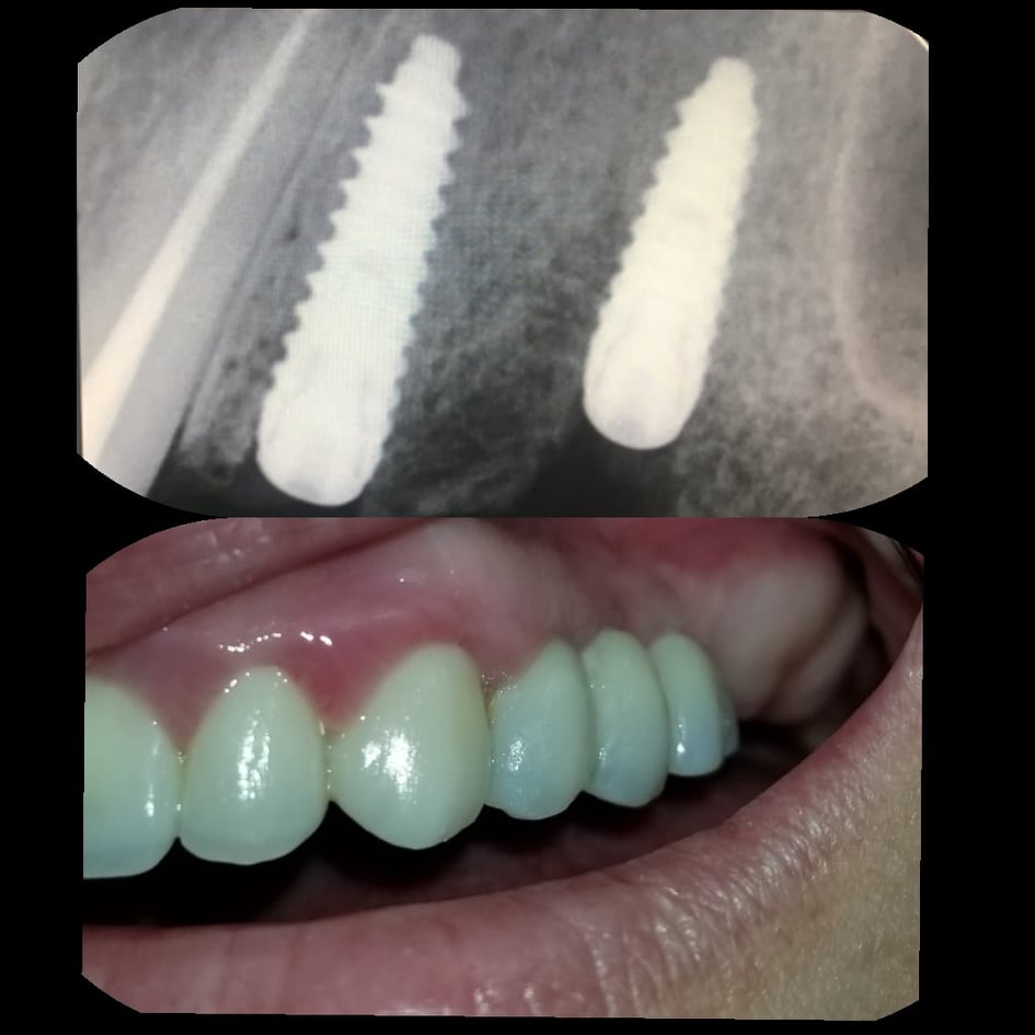 ______Klinike-dentare-vlore-16