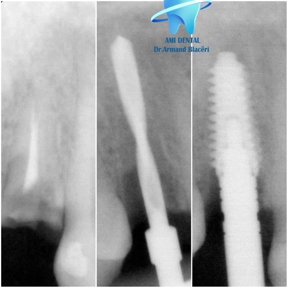 ______Klinike-dentare-vlore-162