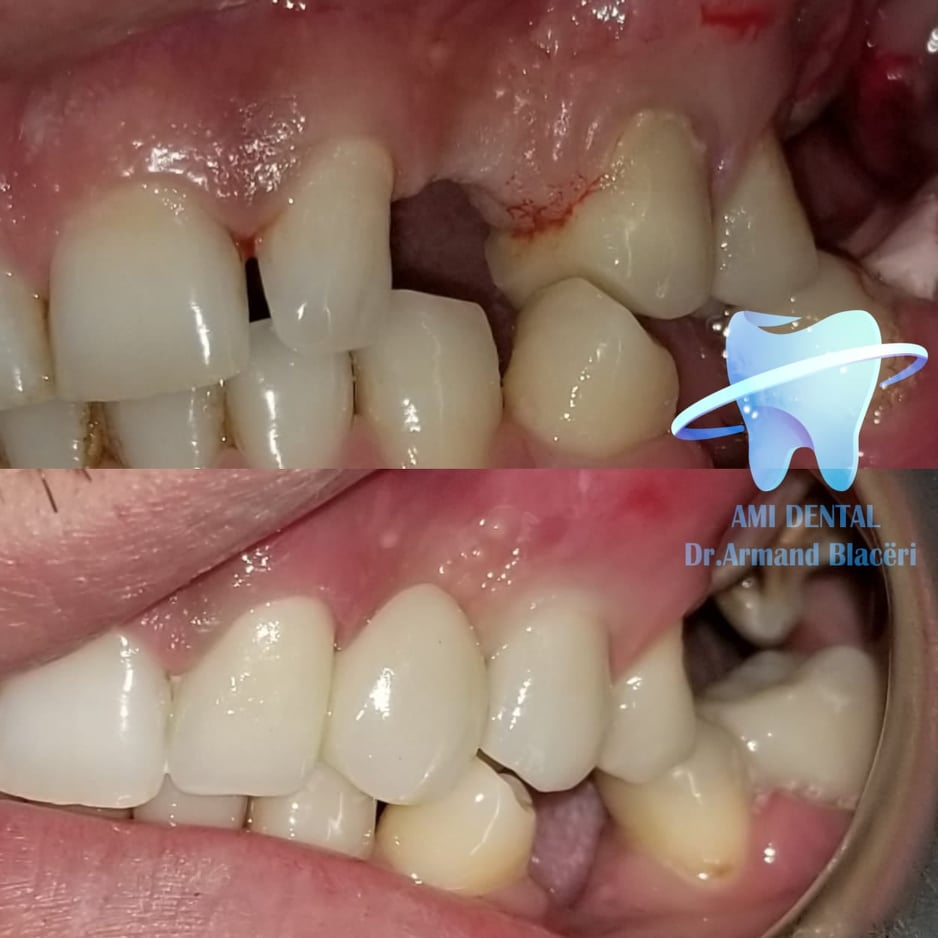 ______Klinike-dentare-vlore-19