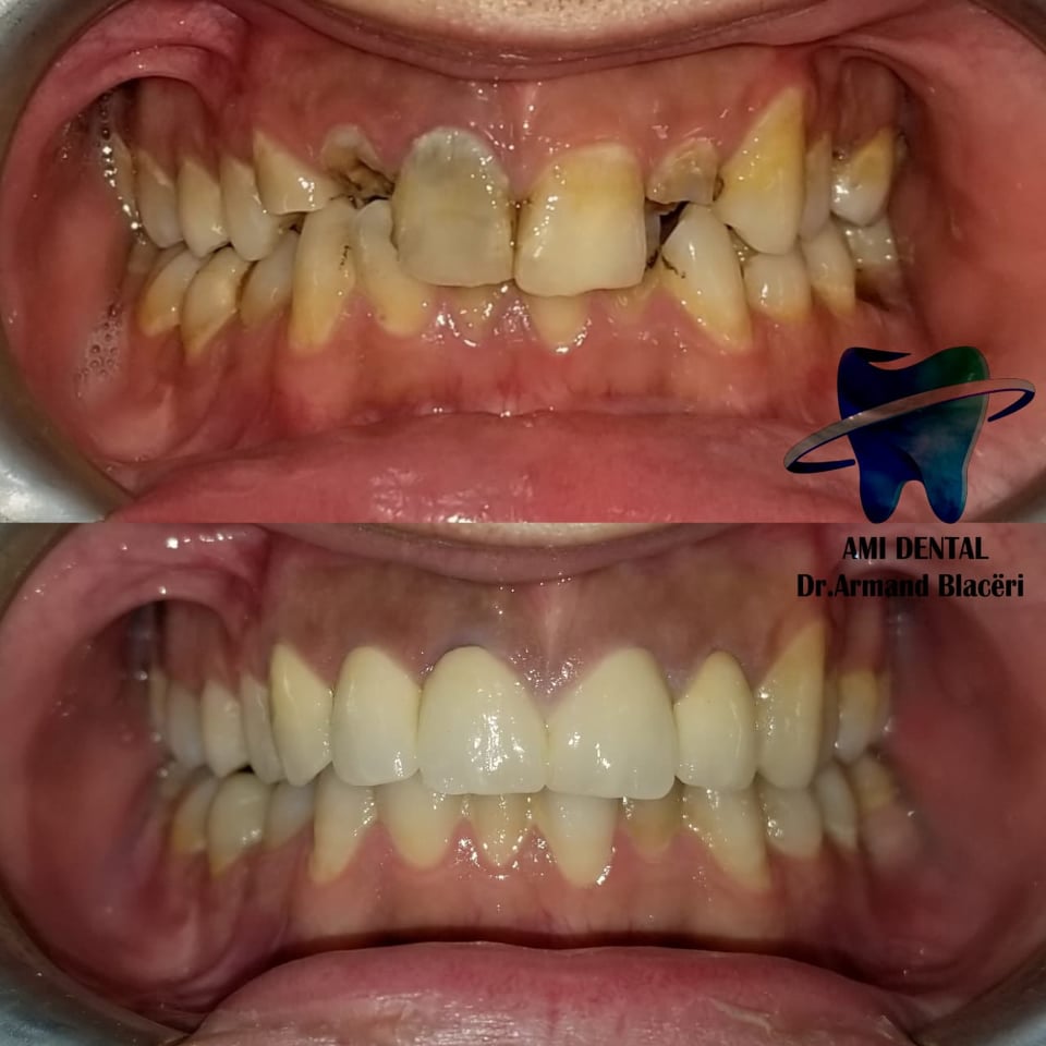 ______Klinike-dentare-vlore-2