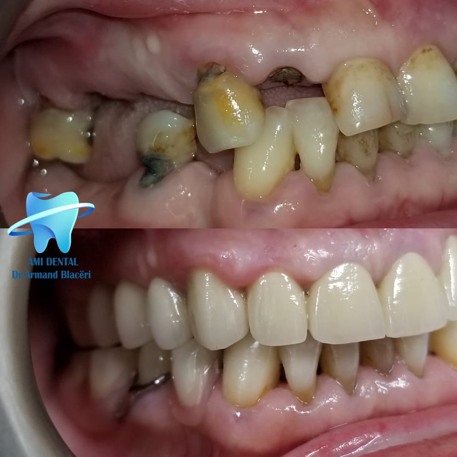 ______Klinike-dentare-vlore-21