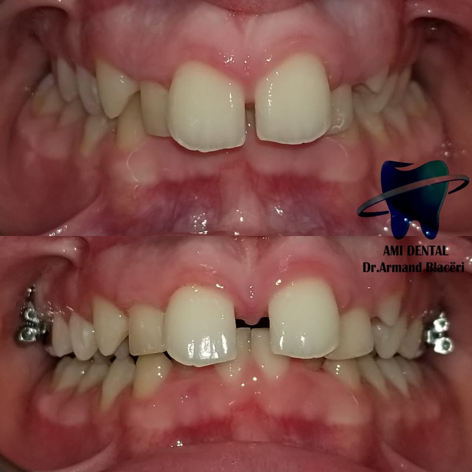 ______Klinike-dentare-vlore-22
