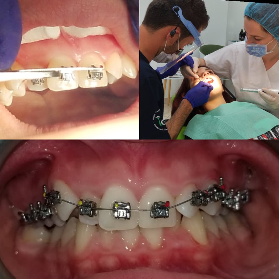 ______Klinike-dentare-vlore-dentist