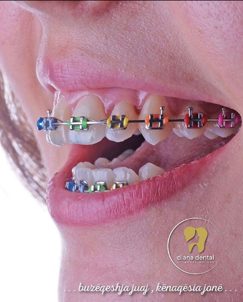 __dentiste-ne-tirane-17