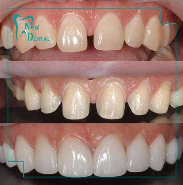 dental-new-klinike-tirana-11