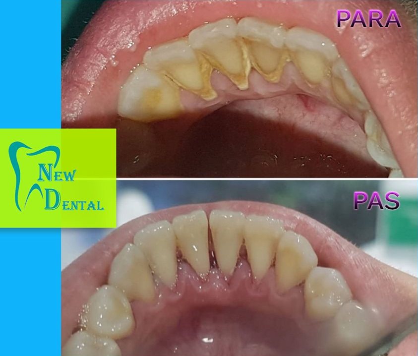 dental-new-klinike-tirana-16