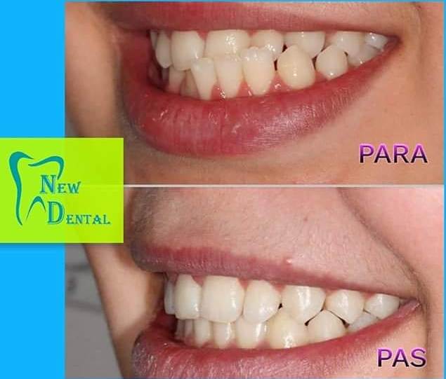 dental-new-klinike-tirana-19