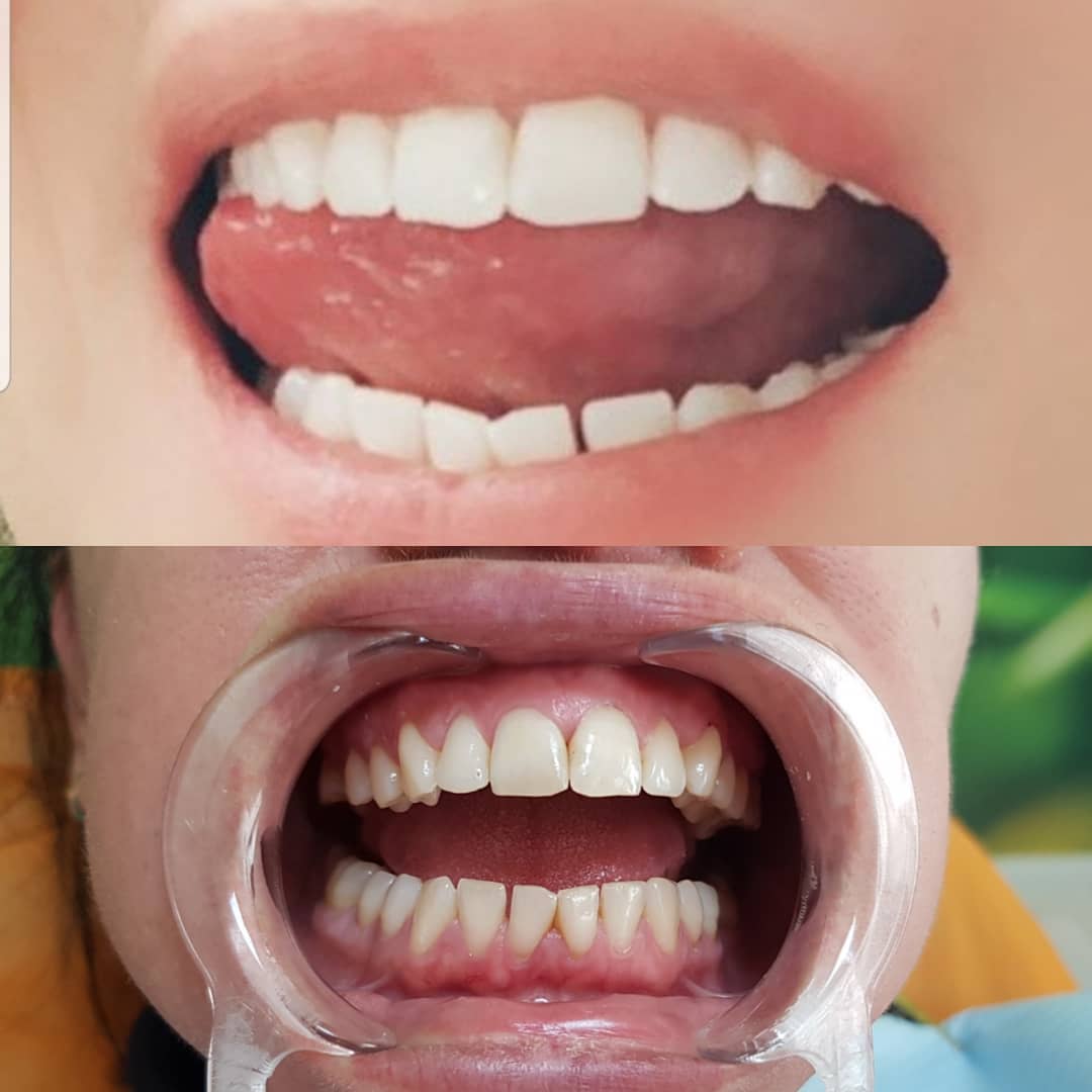 klinike-dentare-selite-16