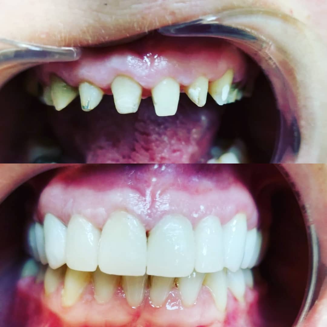 klinike-dentare-selite-17