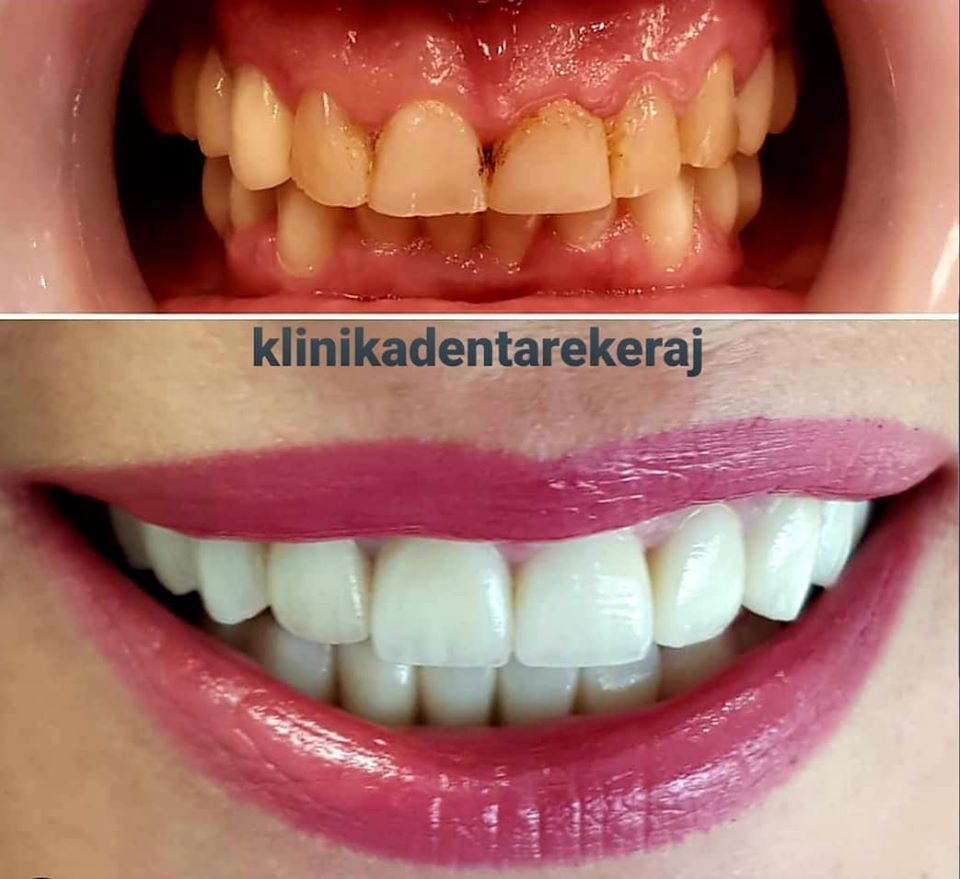 ____klinike-dentare-tirane-13