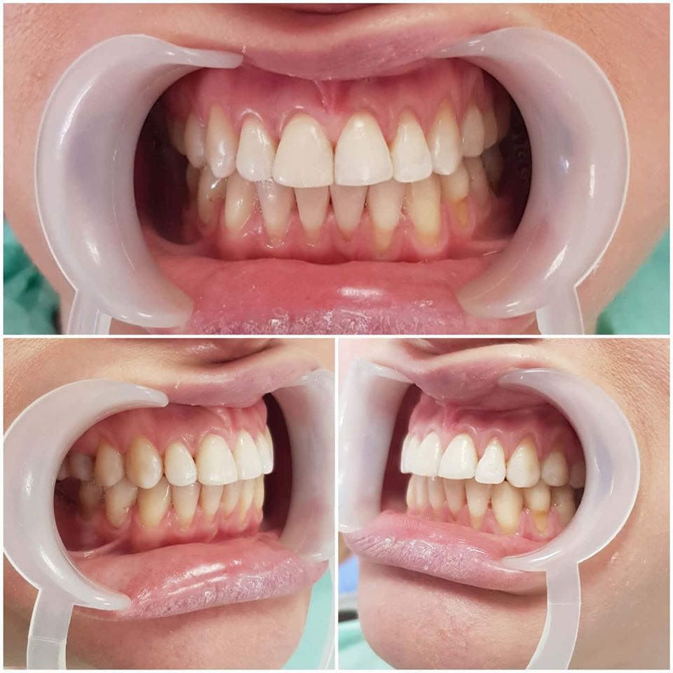 ____klinike-dentare-tirane-17