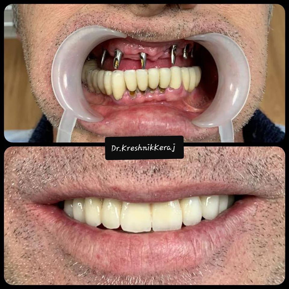 ____klinike-dentare-tirane-18