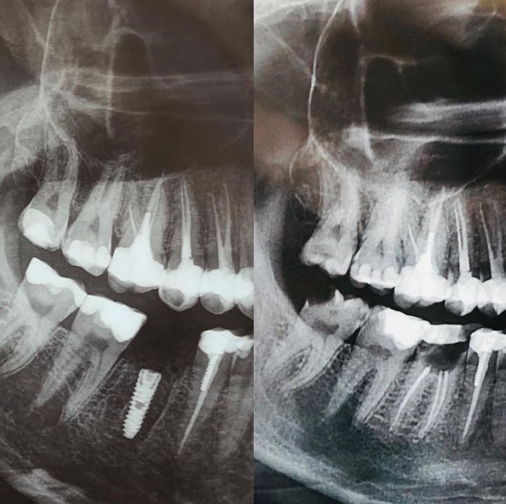 ___klinike-dentare-komuna-parisit-192