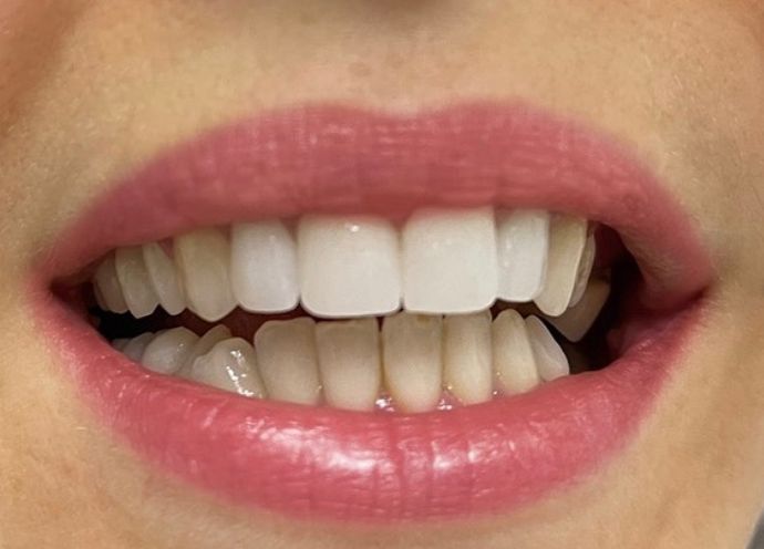 ___klinike-dentare-komuna-parisit-195