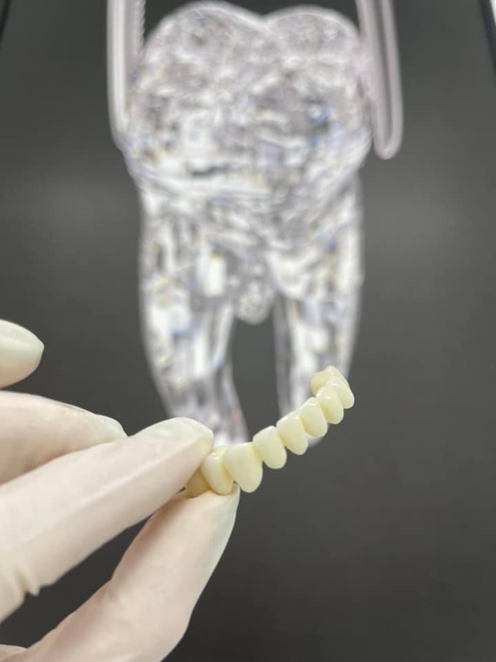 dentist-klinike-dentare-xhamllik-porcelan-145