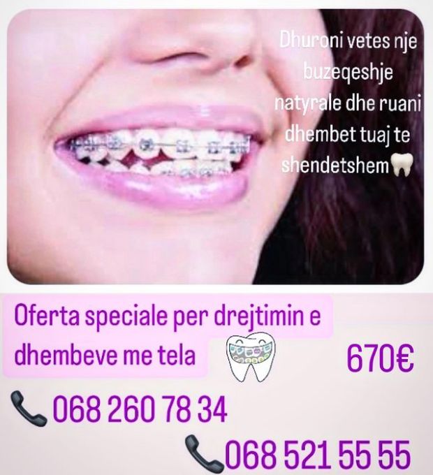 dentist-klinike-dentare-xhamllik-porcelan-198