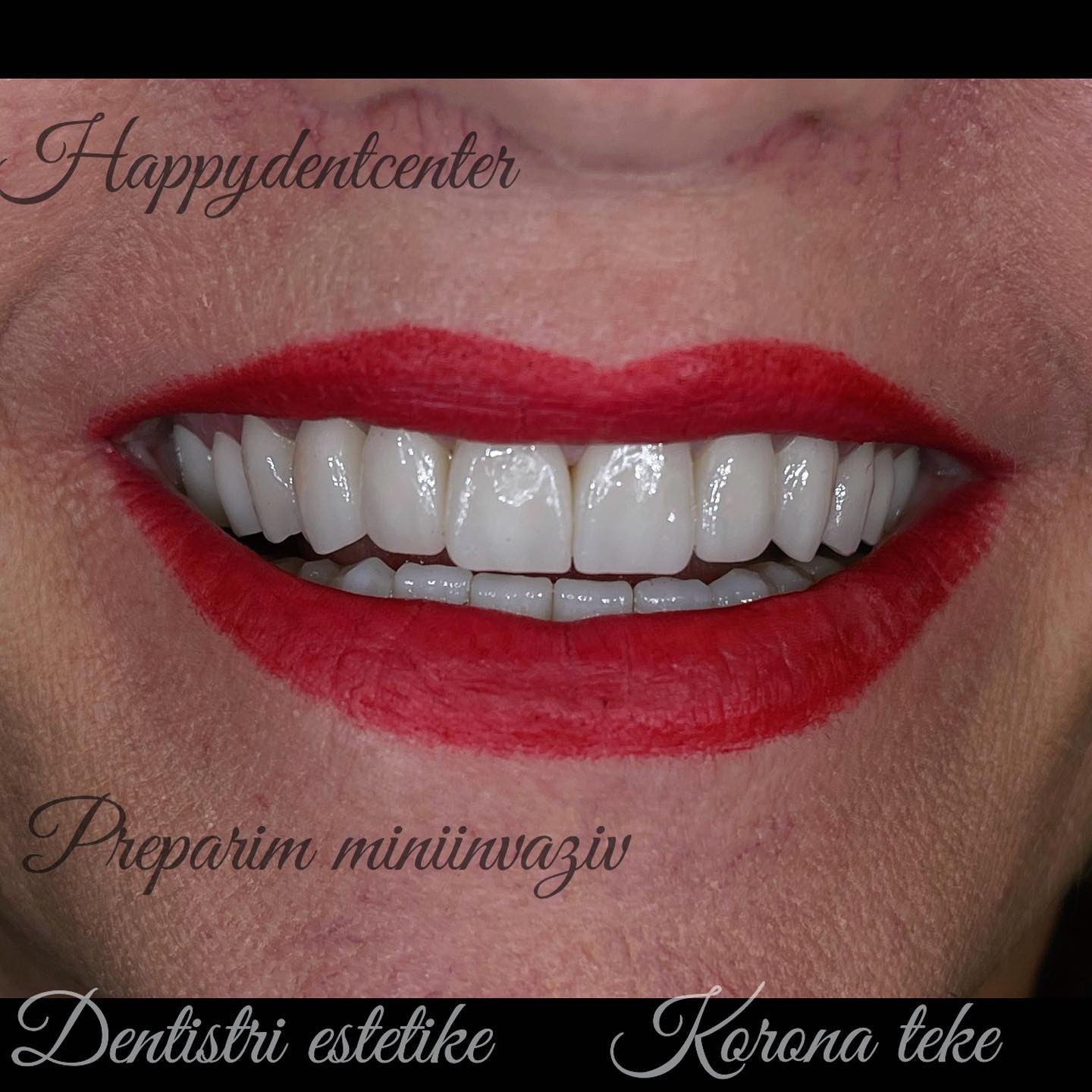 __________klinike-dentare-kombinat-yzberisht-135