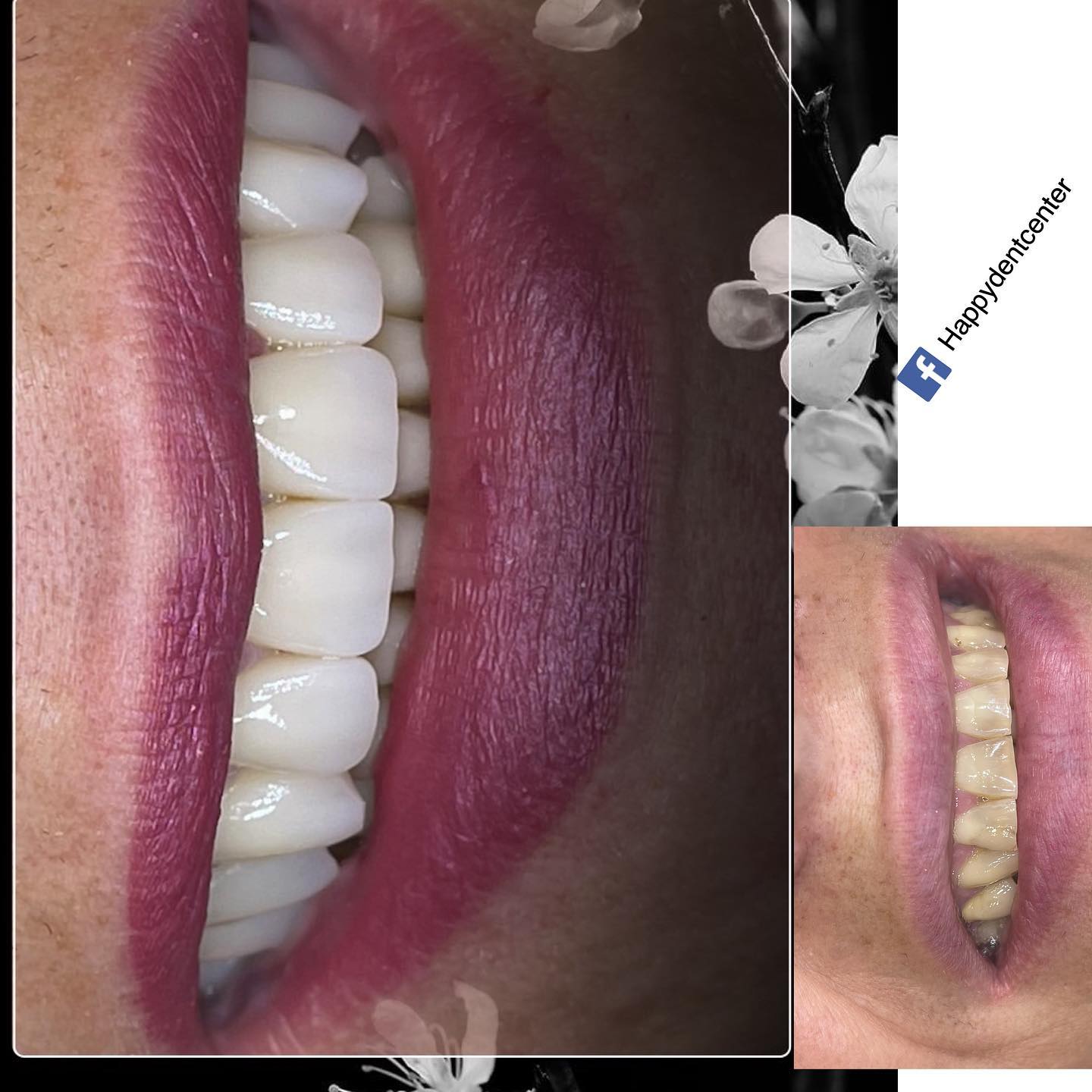 __________klinike-dentare-kombinat-yzberisht-17