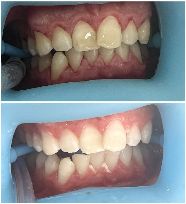 _dentist-klinike-dentare-dures-14