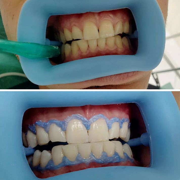 _dentist-klinike-dentare-dures-141