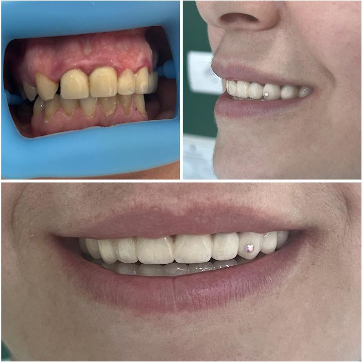 _dentist-klinike-dentare-dures-16