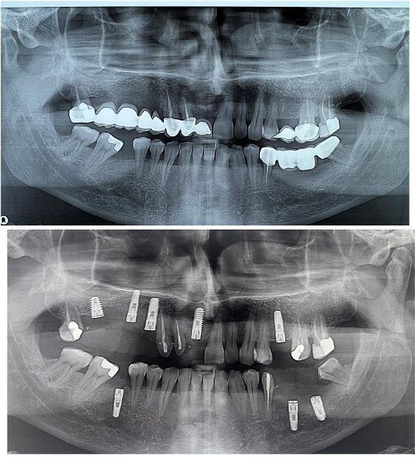 _dentist-klinike-dentare-dures-17