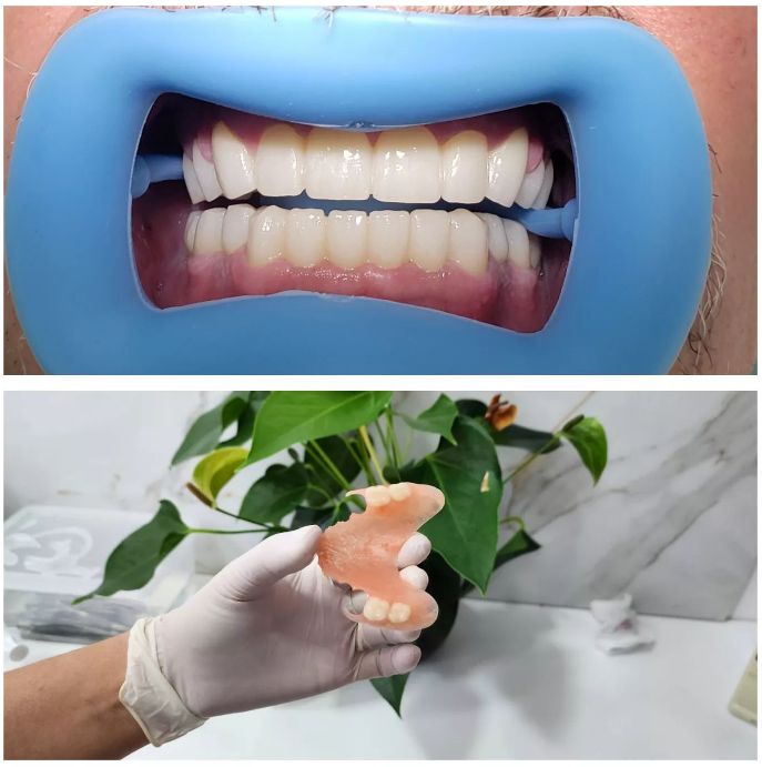 _dentist-klinike-dentare-dures-174