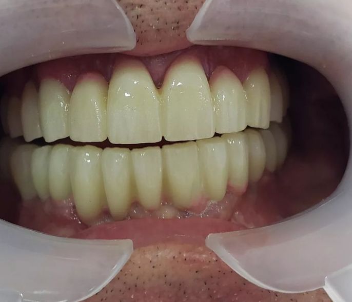 _dentist-klinike-dentare-dures-182