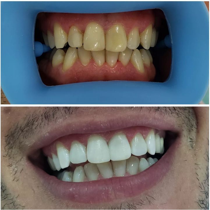 _dentist-klinike-dentare-dures-183