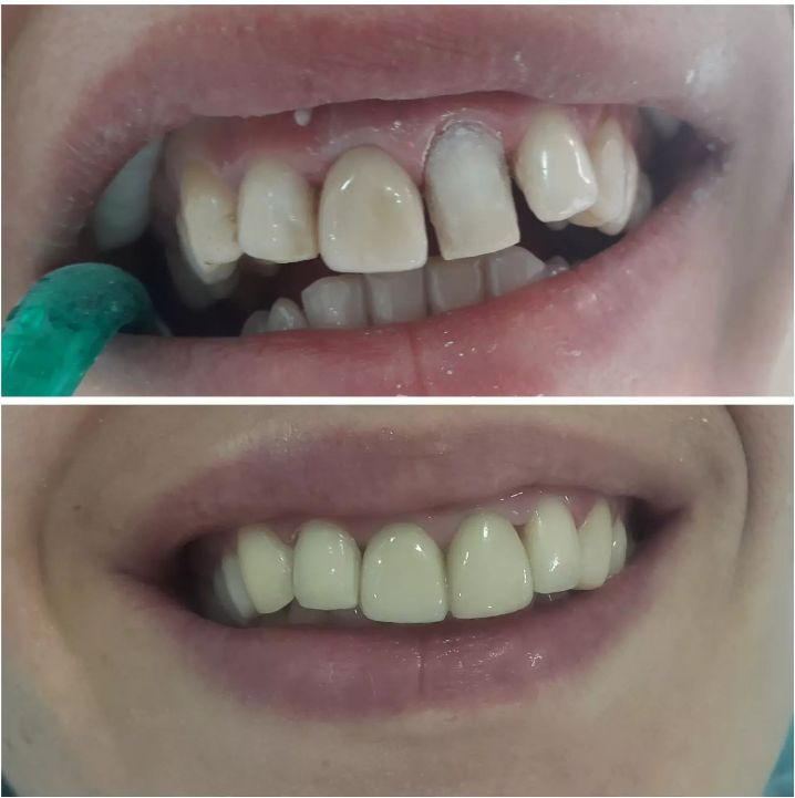 _dentist-klinike-dentare-dures-184