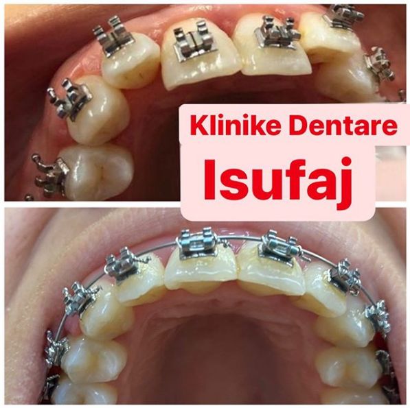 astir dentiste tirane 4
