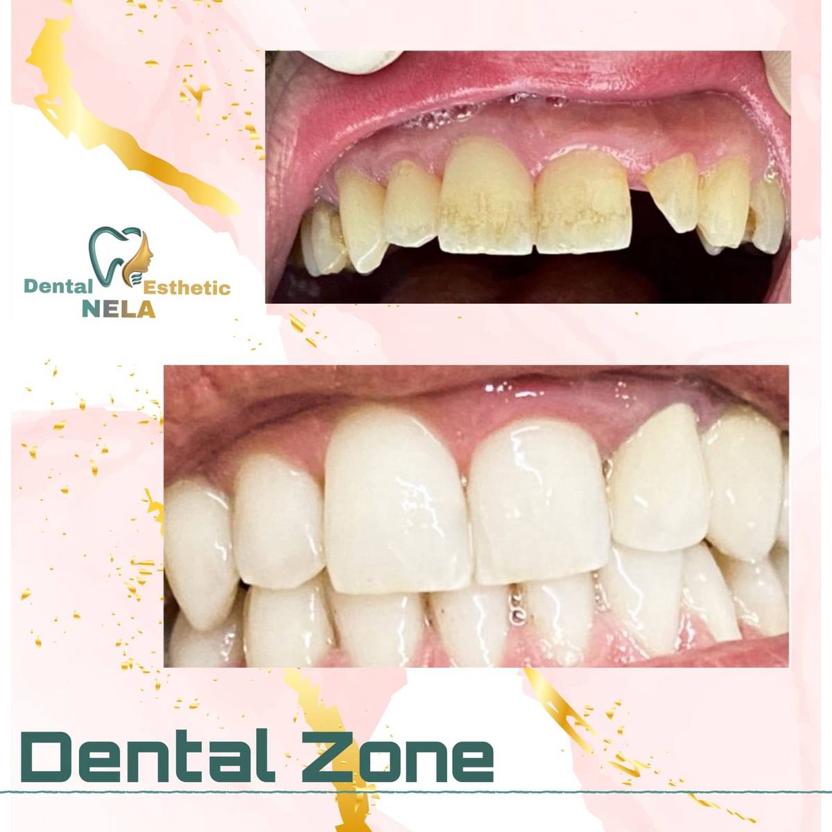 DENTIST-KLINIKE-DENTARE-SAUK-TIRANE-10