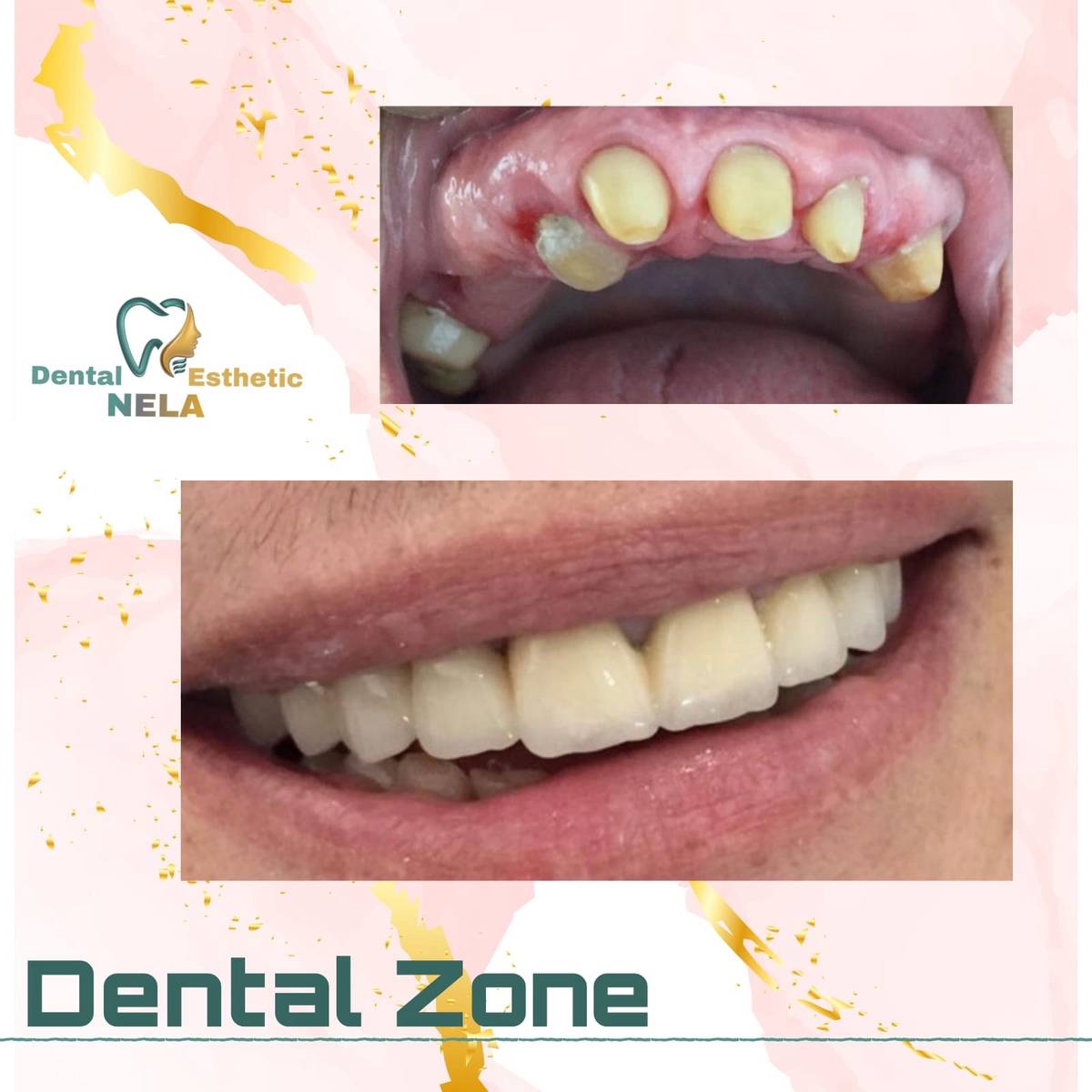 DENTIST-KLINIKE-DENTARE-SAUK-TIRANE-100