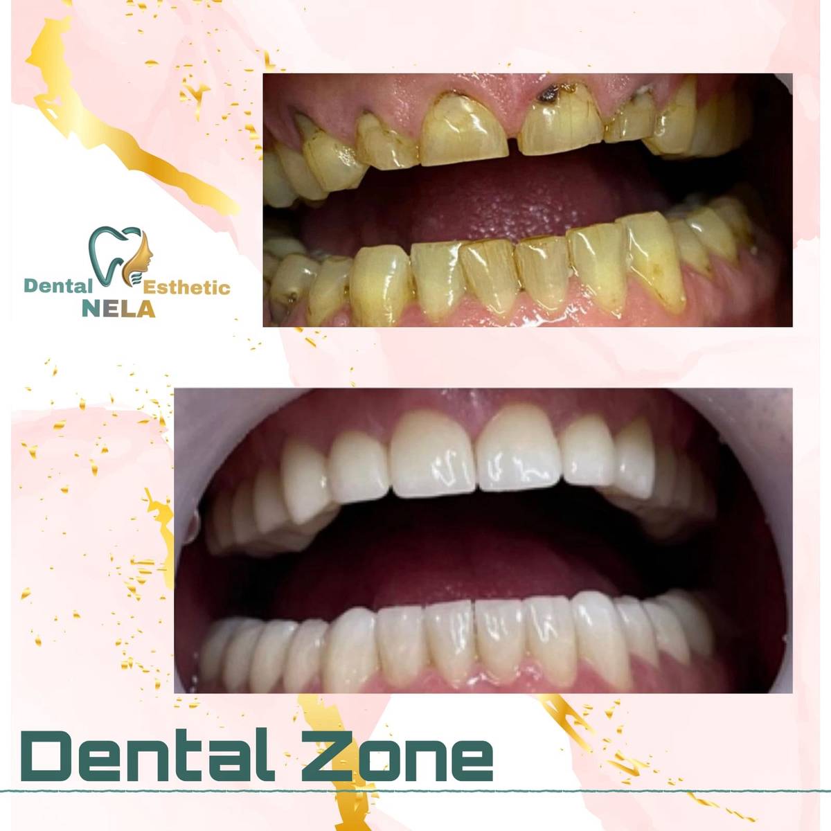 DENTIST-KLINIKE-DENTARE-SAUK-TIRANE-1001