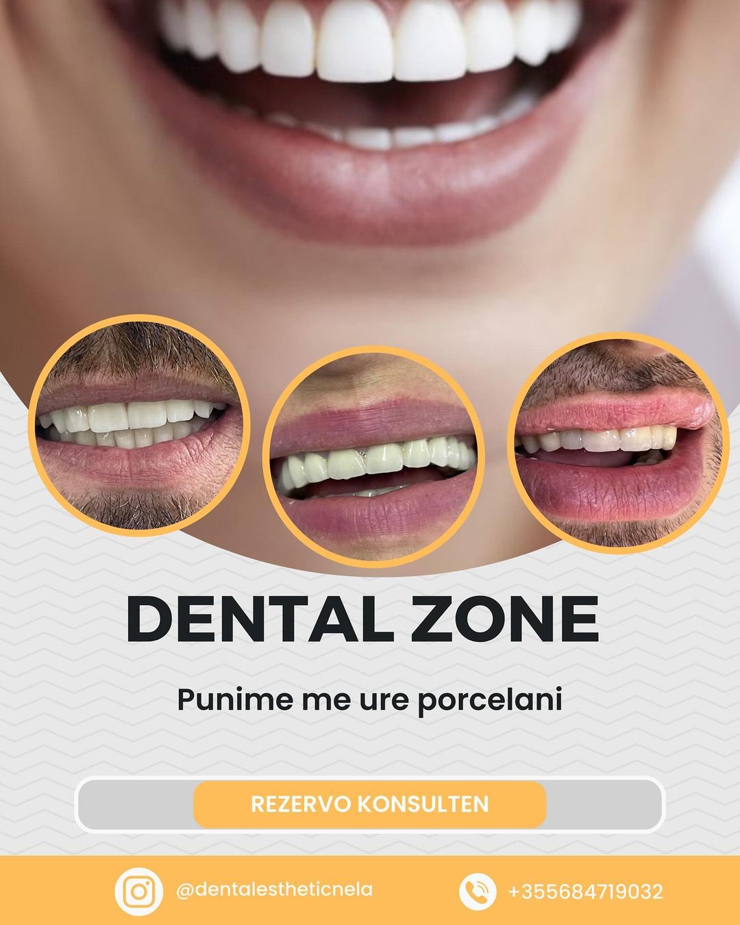 DENTIST-KLINIKE-DENTARE-SAUK-TIRANE-11