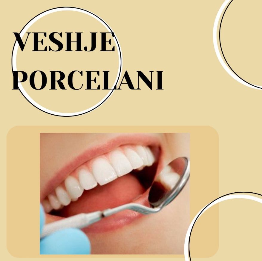 DENTIST-KLINIKE-DENTARE-SAUK-TIRANE-14