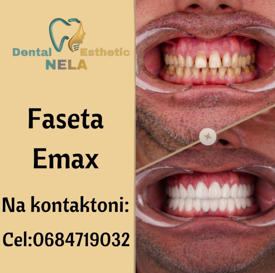 DENTIST-KLINIKE-DENTARE-SAUK-TIRANE-15