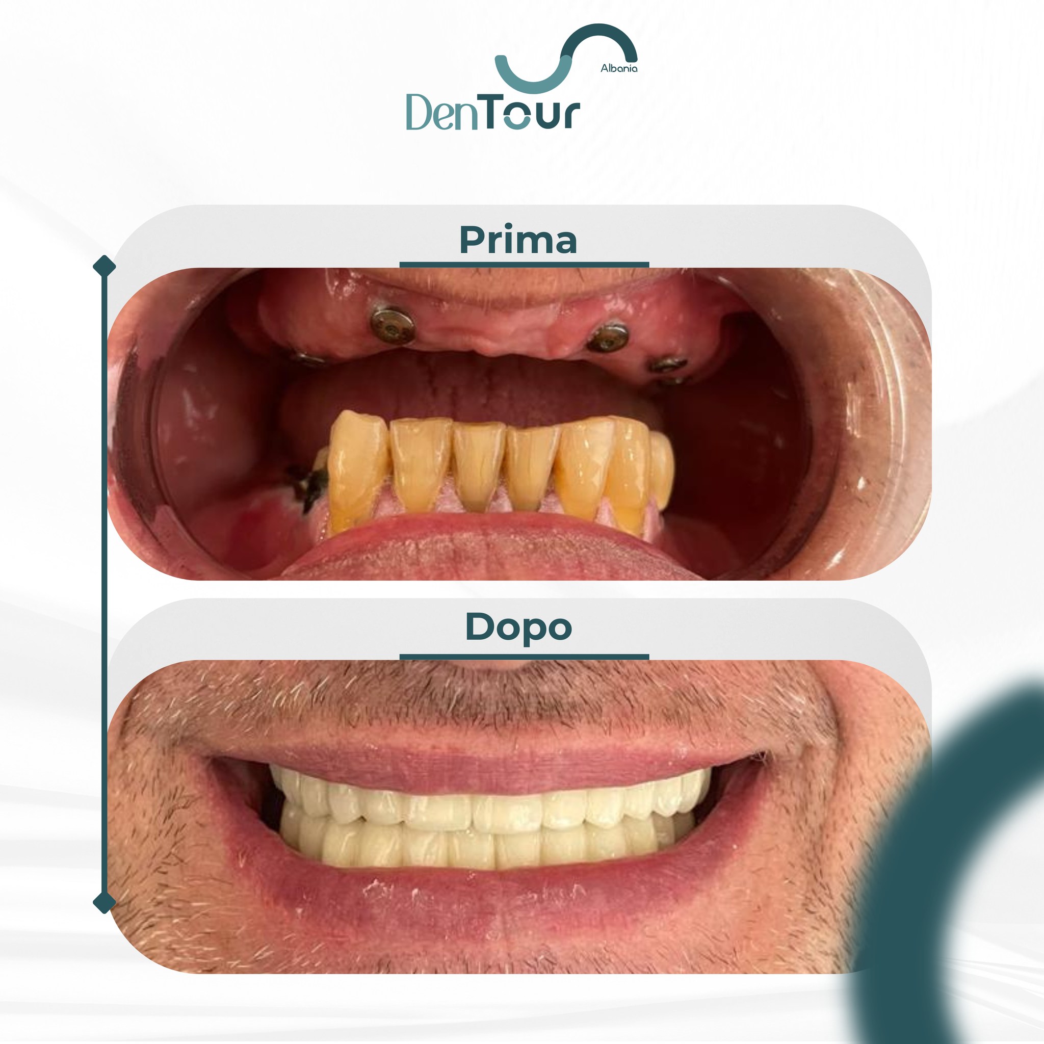 dentour-turismo-dentale-197